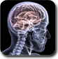 Una radiografía del cerebro de una persona