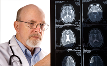 Un médico examina la radiografía del cerebro de una persona