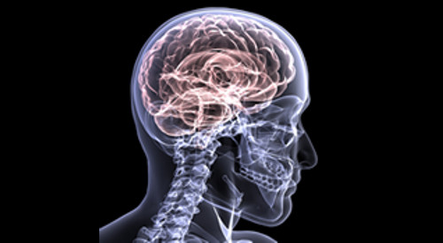 Una radiografía del cráneo y el cerebro